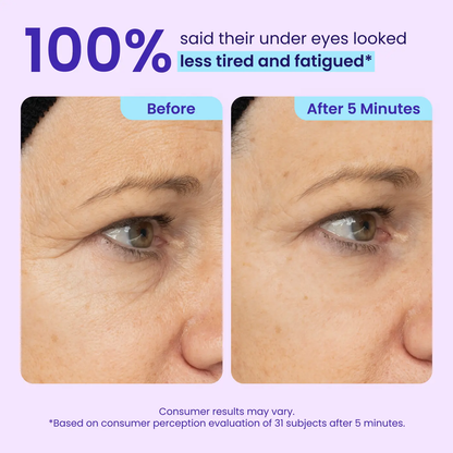 Eye Bag Instant Eraser, Tightens, Firms, & Blurs Wrinkles