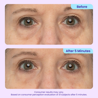 Eye Bag Instant Eraser, Tightens, Firms, & Blurs Wrinkles