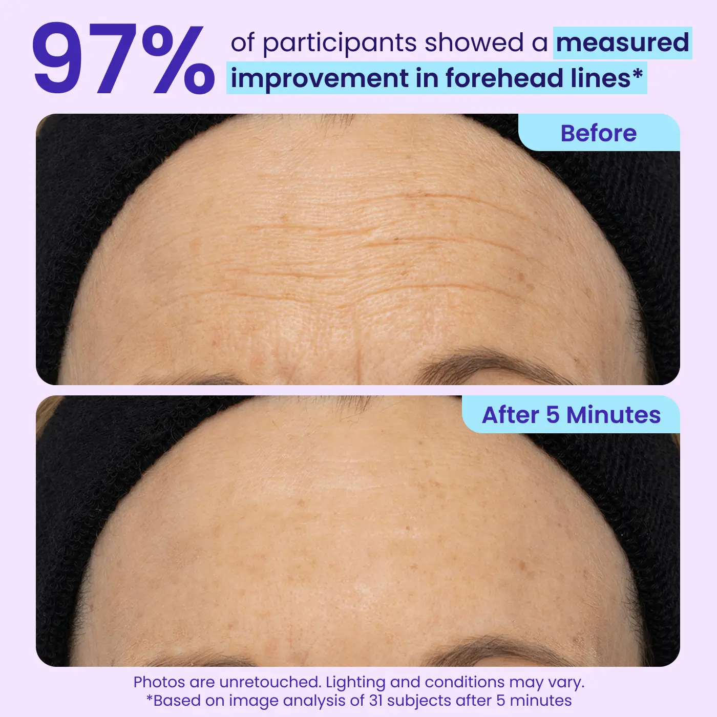 Eye Bag Instant Eraser, Tightens, Firms, & Blurs Wrinkles