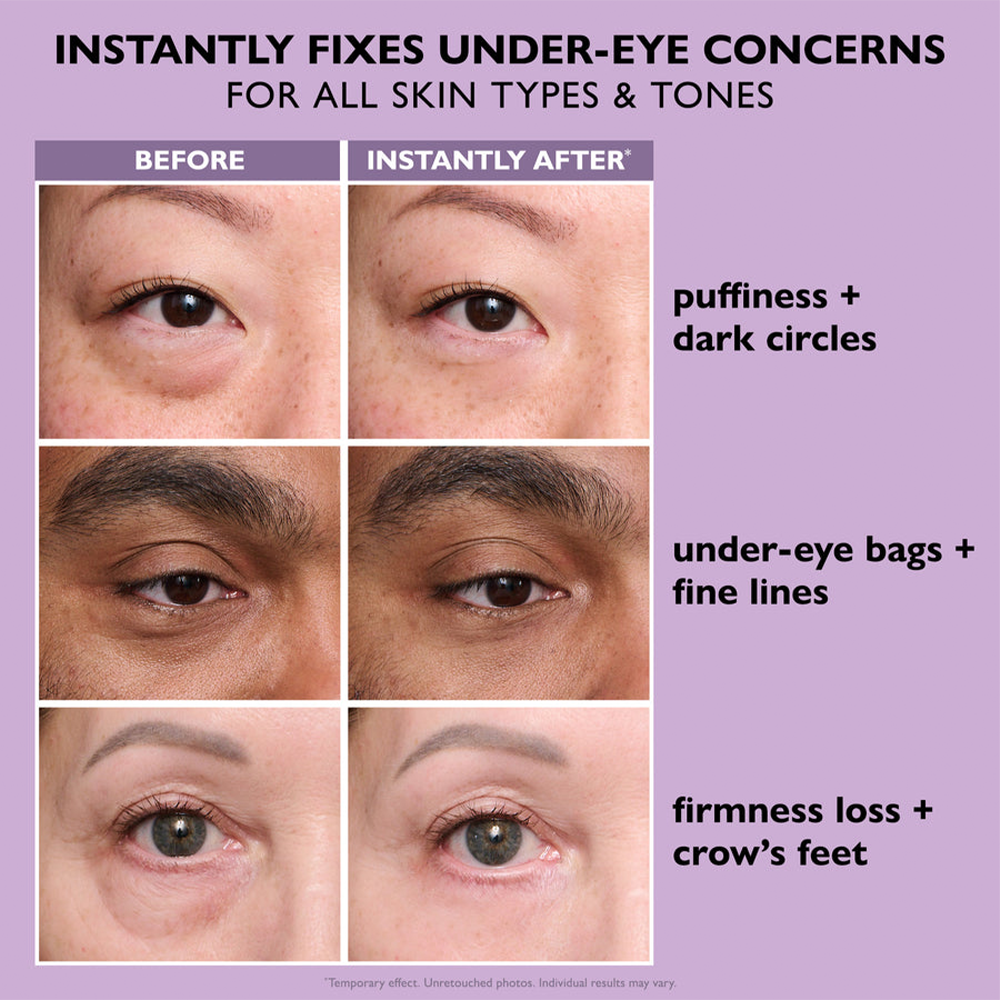Eye Bag Instant Eraser, Tightens, Firms, & Blurs Wrinkles