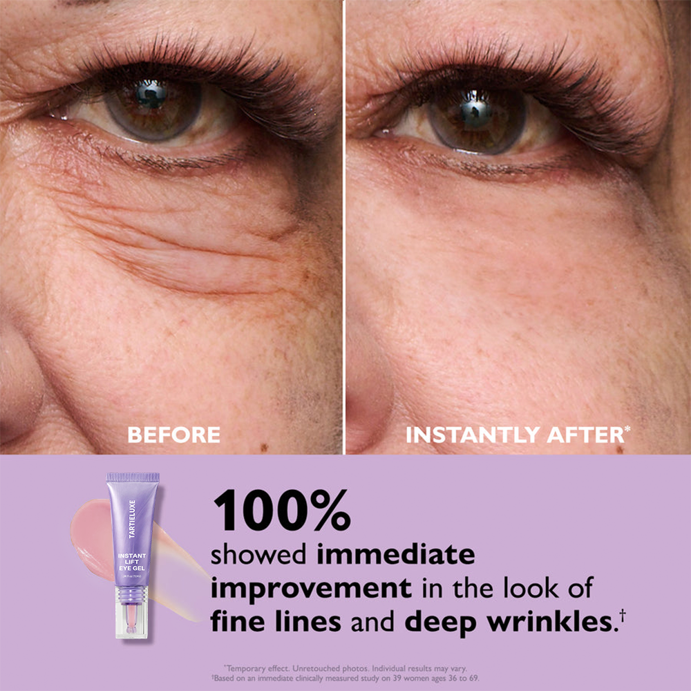Eye Bag Instant Eraser, Tightens, Firms, & Blurs Wrinkles